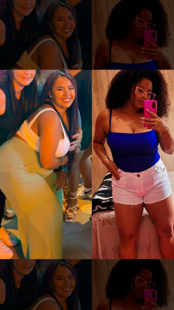 Antes e depois 1